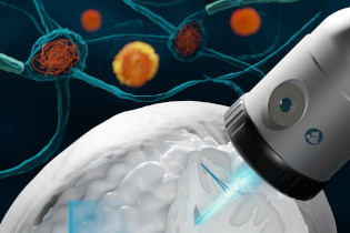 Einleitungsbild für Innovation aus Wien: Ultraschall zur Behandlung von Gehirnkrankheiten